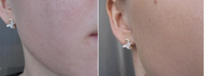 Eisenberg Invisible corrective makeup 01 natural / Тональная основа