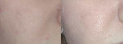 Sea of spa  Dead Sea Treatment Black Mud Soap - Натуральное грязевое мыло для лица и тела