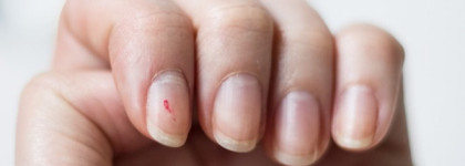 Парочка-выручалочка для мох 10 братьев. Limoni Уход за кутикулой