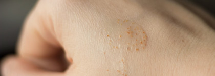 Коллекция моих пилингов и скрабов для кожи головы. От лучшего к худшему. DSD de Luxe, Londa Professional, Natura Siberica