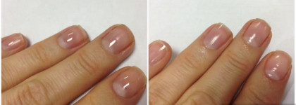 Кто виноват и что делать? - борьба со слоением ногтей