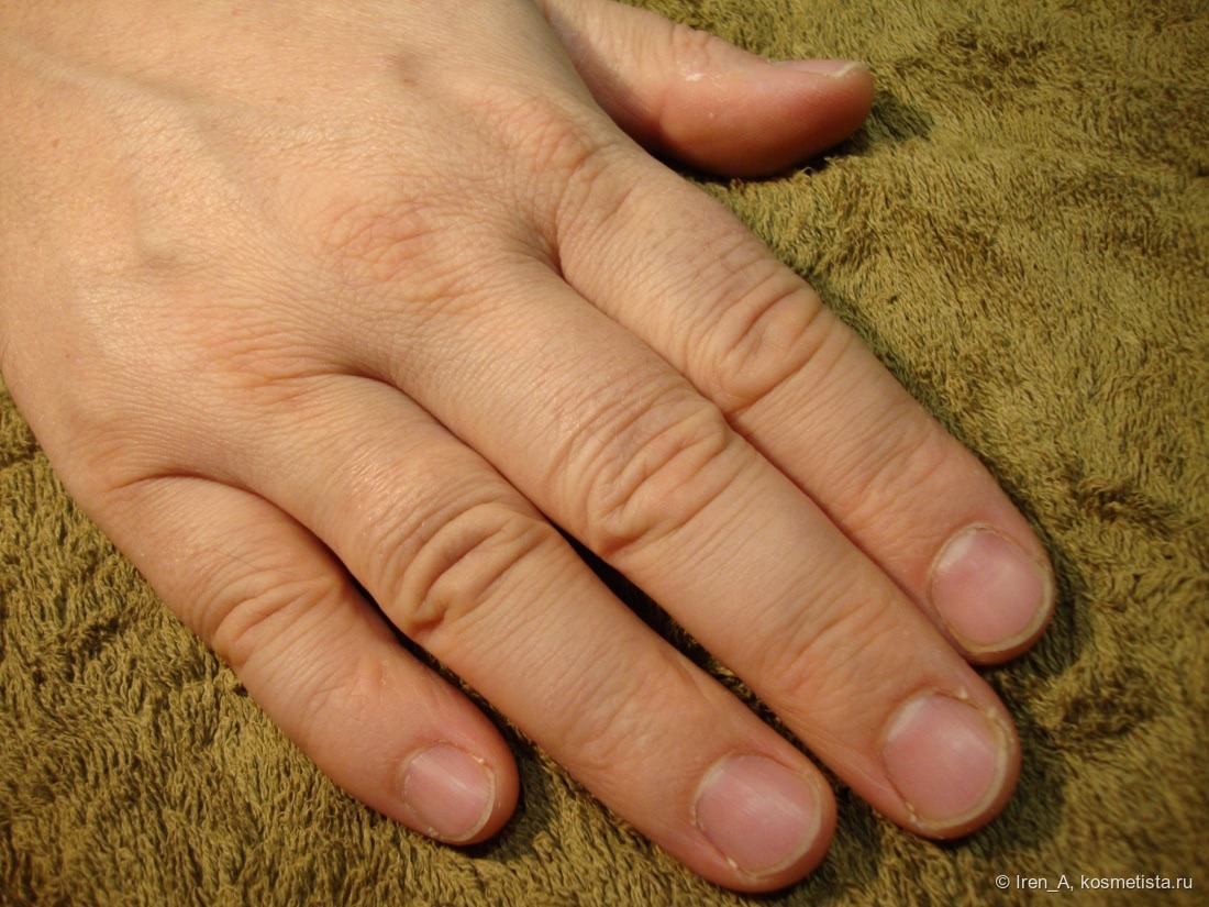 Ногти на больших пальцев мужчин. Мужской маникюр. Мужские ногти. Ногти без маникюра неухоженные. Мужские пальцы.