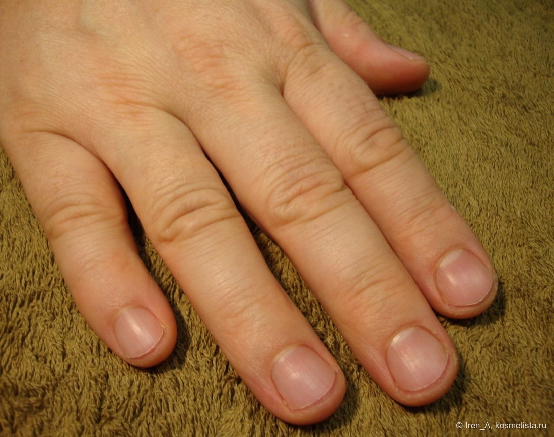 Какие должны быть ногти у здорового человека. Здоровые мужские ногти. Мужские ногти на руках. Нормальные мужские ногти. Ухоженные мужские ногти.