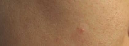 Чудо-пластырь корейского происхождения Skin Food Trouble Clear Spot Patch