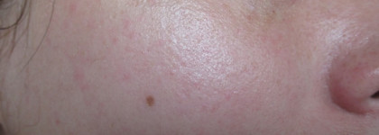 Звенья одной цепи! Маски El' Skin и SkinLite