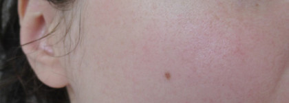 Лицом в салат? То есть салат на лицо! Superfood Salad For Skin