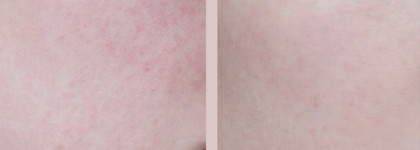 Зелененький он был... или  Базой по куперозу с Mufe HD Primer Green и MAC Prep+Prime Fortified Skin Enhancer Spf35 Neutralize