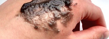 Снова ты! Маски для лица Freeman