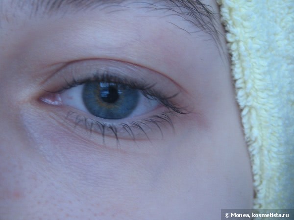 Как убрать морщины вокруг глаз?