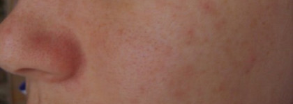 Мой постоянный обитатель косметички - Тональный крем Lancome Teint Miracle № 010 Beige Porcelaine