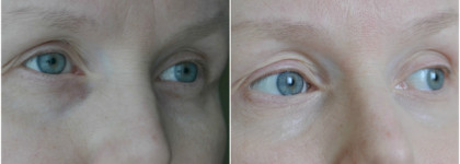 Консилер Max Factor Mastertouch Concealer. Оттенок Ivory 303