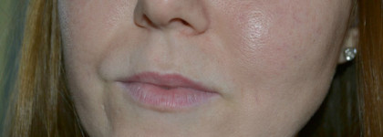 Легендарный Bor-Tox от Medi-Peel с эффектом ботокса. 