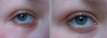 Идеальный пятновыводитель: NYX full coverage concealer jar cj02 Fair vs bareMinerals Multi-Tasking Bisque Spf20