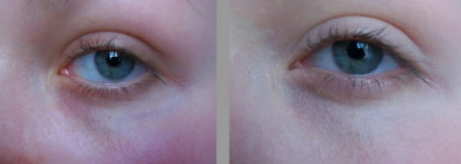Идеальный пятновыводитель: NYX full coverage concealer jar cj02 Fair vs bareMinerals Multi-Tasking Bisque Spf20