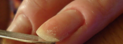 Набор для ремонта ногтей Orly Nail Rescue