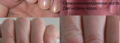 Ваша карта бита - сдавайтесь. Или как "Орленок" "Опенка" победил
