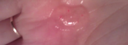 Записки скрабоголика. Часть первая. Пенная