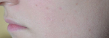 Lancome Hydra Zen Teinte Neurocalm SPF 15 - Увлажняющий крем с тонирующим эффектом (оттенок 01, Naturel)