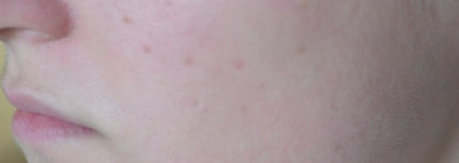 Lancome Hydra Zen Teinte Neurocalm SPF 15 - Увлажняющий крем с тонирующим эффектом (оттенок 01, Naturel)