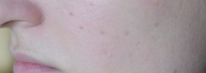 Lancome Hydra Zen Teinte Neurocalm SPF 15 - Увлажняющий крем с тонирующим эффектом (оттенок 01, Naturel)