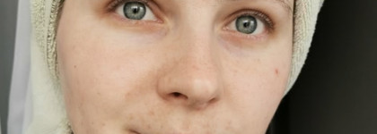 Спасительное SuperDuo для моей кожи: салицилка "Rejudicare" и пробиотики от "Гельтек"