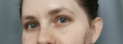 Спасительное SuperDuo для моей кожи: салицилка "Rejudicare" и пробиотики от "Гельтек"