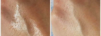 Ластик для постакне Cosmedix Simply Brilliant 24/7 Brightening Serum