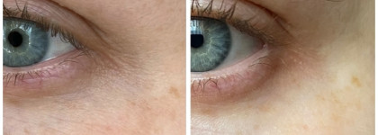 SVR Ampoule clairial - концентрат для ровного тона кожи