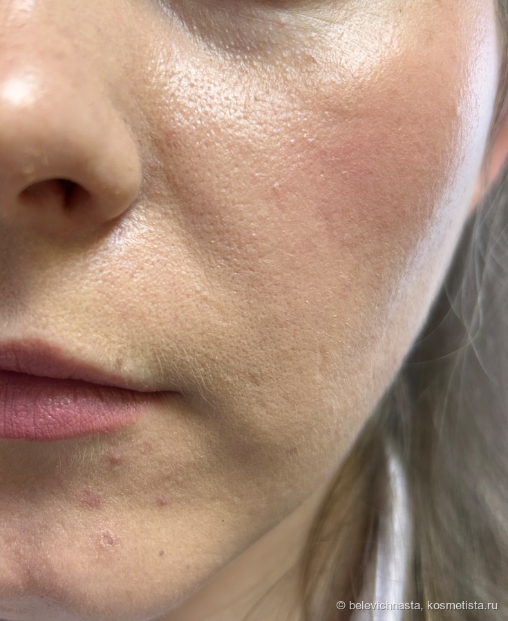 Искусственное освещение. Так он проявляется гораздо чаще.