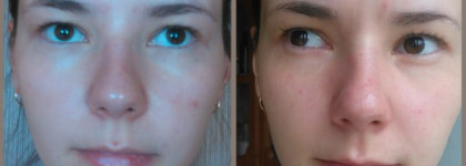 Крем для лица Tony Moly Red Appletox Honey Cream + небольшой совет