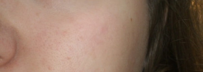 Lumene Color correcting Cream "Абсолютное совершенство" в оттенке Light