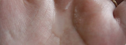 Средства для проблемной кожи Acnacid