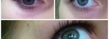 Прошу совета в выборе крема для кожи вокруг глаз