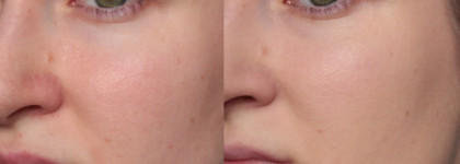 Тональная сыворотка Dior Capture Totale Serum de Teint SPF 25 в оттенке 010 ivory