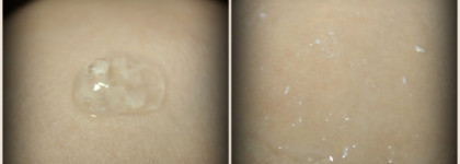 Мои пилинги