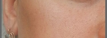 Star Bronzer Intense - Стойкая пудра с бронзирующим эффектом от Lancome в оттенке 03 - Eclat bronze