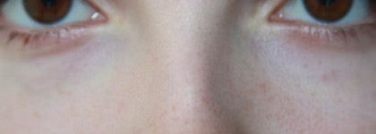 Skinfood - Black Egg Pore Primer