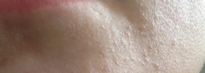 Amway Artistry Intensive Skincare Renewing Peel Обновляющий пилинг для кожи лица