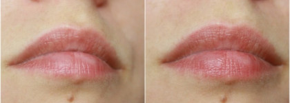 Mirra гель для коррекции объема и формы губ daily