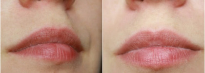 Mirra гель для коррекции объема и формы губ daily