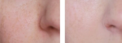 Limoni BB Cream Snail Repair тон №1 - В борьбе за красивую кожу вместе с улитками