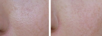 Матирующая компактная пудра Limoni Transparent Matte Powder: 5-6 часов без блеска? Легко