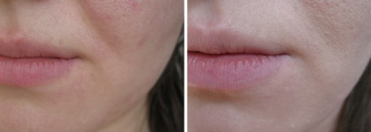 Мой бархатистый Chanel Perfection Lumiere Velvet Smooth-Effect Makeup SPF 15 10 Beige
