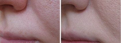 Пост про тон не для зимы. Diorskin Nude Air Ultra-Fluid Serum Foundation Spf25- PA++ #010 Ivory