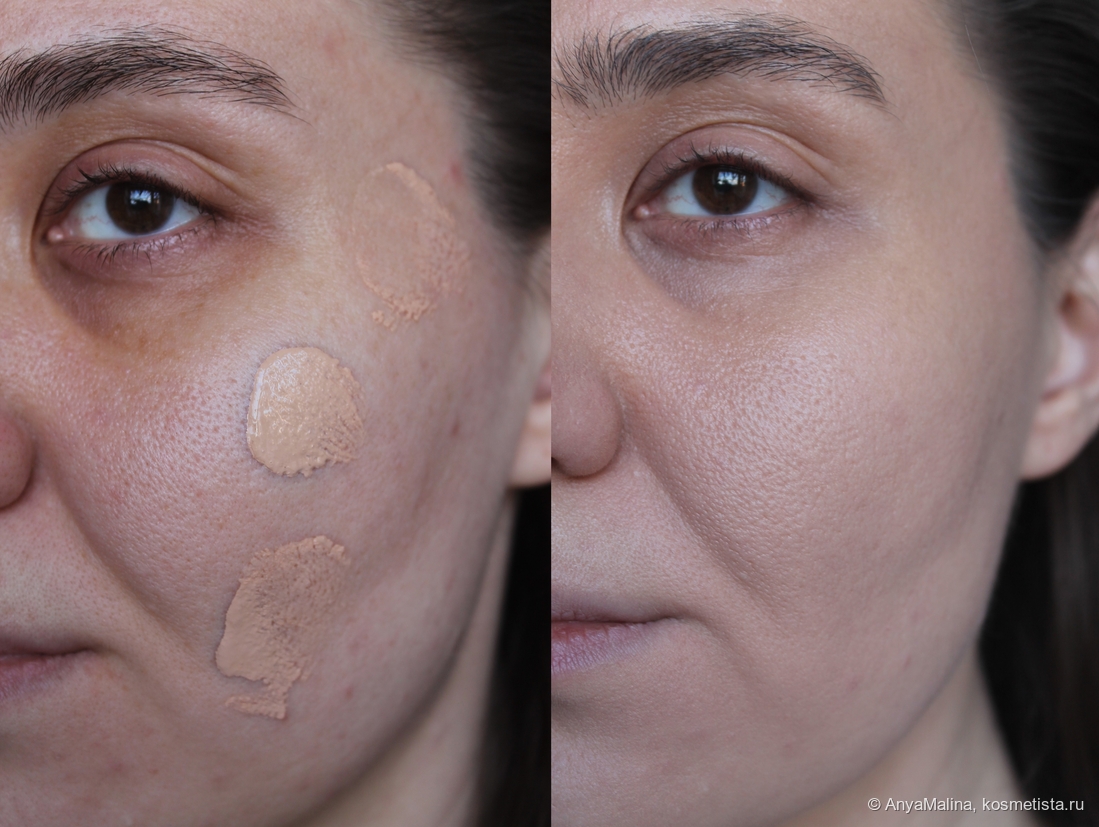 До и после только с новым тоном, на чистую кожу без консилера
