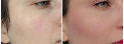 Тональная сыворотка с антивозрастным действием YSL Youth Liberator Serum Foundation SPF 20 PA++ в оттенке #BR 20