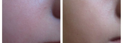 Первый отзыв на многофункциональный корректирующий крем Age Defense BB Cream SPF 30 Shade 03 от Clinique