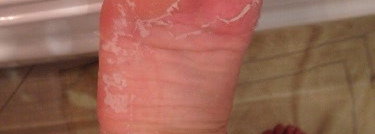 Спасение для проблемных ножек - отшелушивающая маска-носки для ног Skinlite Exfoliating Foot Mask