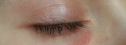 Уход для лица: Filorga простая и немного Filorga Professional