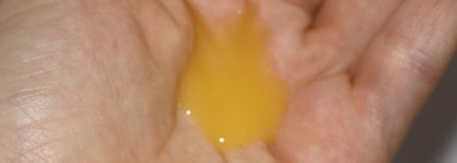 Как я спасла мужа от перхоти